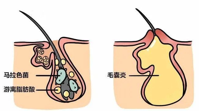 山东中药养发怎么加盟代理 山东发酵中药厂家